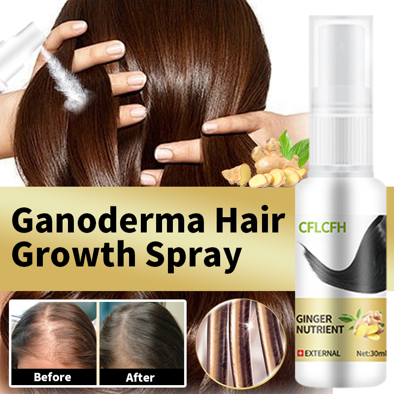 Hair Care Hair Serum - สเปรย์ปลูกผมเร็วขึ้น แก้ปัญหาผมร่วง ผมบาง ศีรษะล้าน สำหรับผู้หญิง บำรุงหนังศีรษะ
