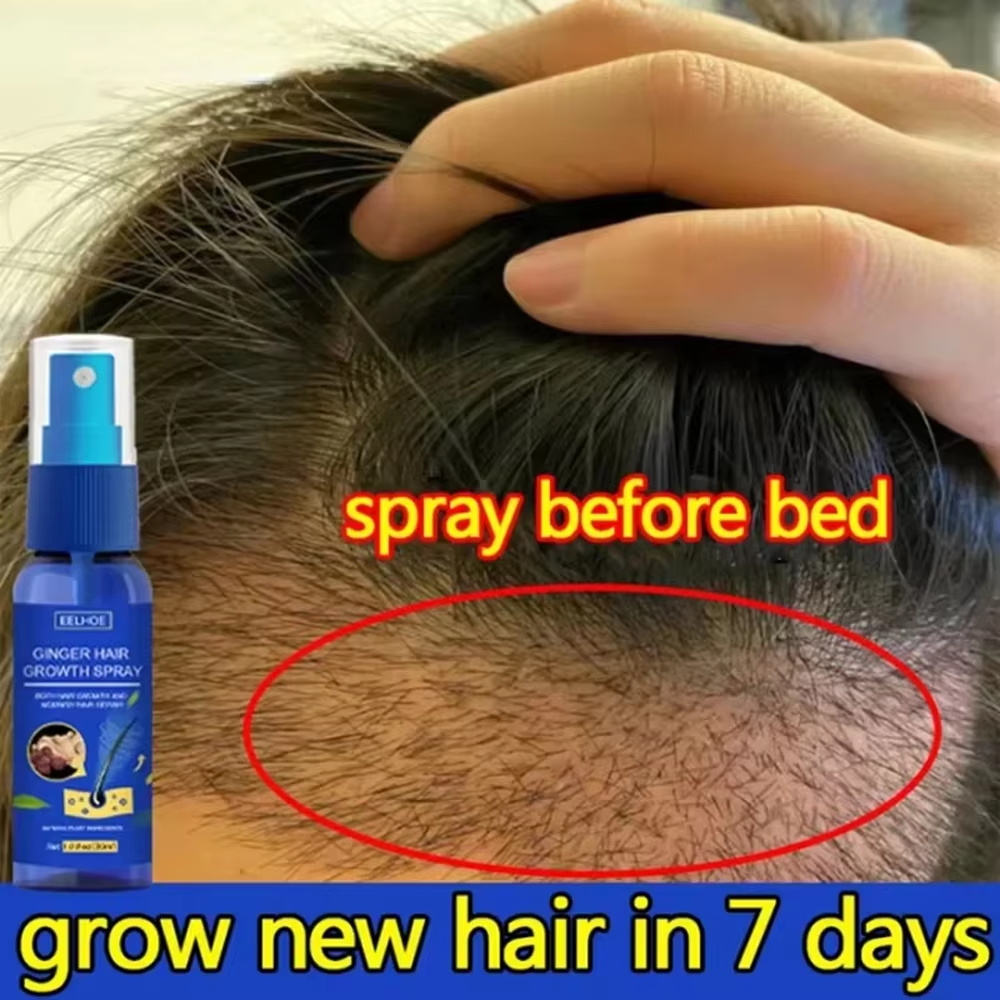 Hair Care Hair Serum - สเปรย์เร่งผมยาวขึ้นอย่างรวดเร็ว บำรุงรากผม ป้องกันผมร่วง เซรั่มปลูกผมใหม่ ซ่อมแซมหนังศีรษะที่เสียหาย บำรุงและดูแลเส้นผม