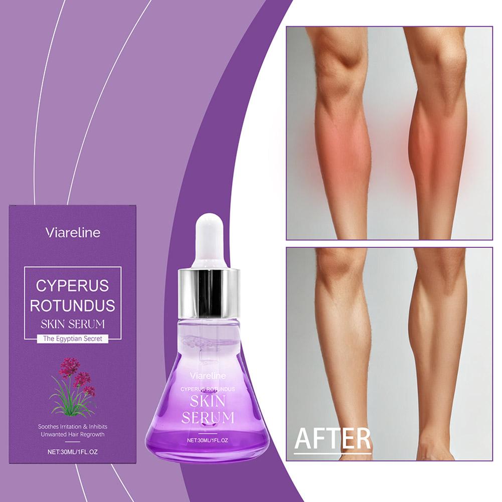 เซรั่มบำรุงหลังกำจัดขน ช่วยปลอ - Hair Care Serum บทวิจารณ์และราคา