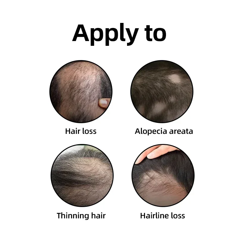 สเปรย์ปลูกผมเร็วขึ้น แก้ปัญหาผ - Hair Care Hair Serum บทวิจารณ์และราคา