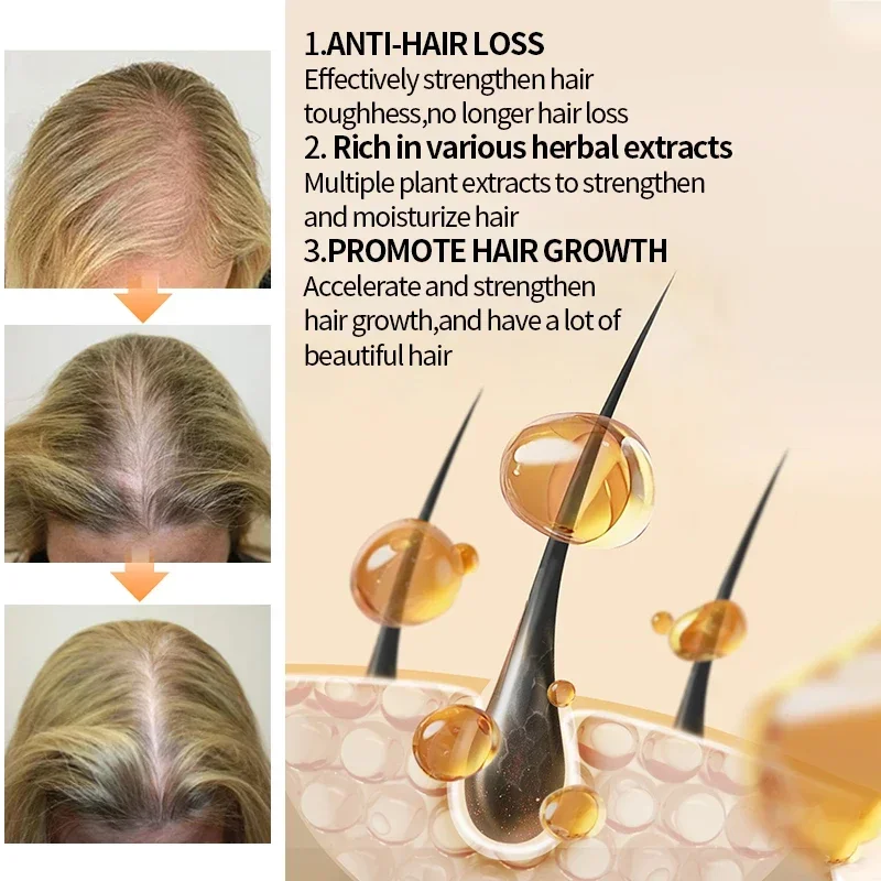 สเปรย์ปลูกผมเร็วขึ้น แก้ปัญหาผ - Hair Care Hair Serum บทวิจารณ์และราคา
